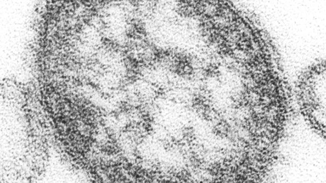 什么麻疹看起来像