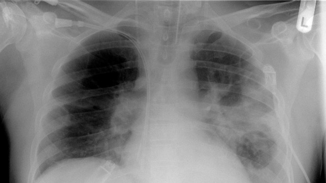 什么麻疹看起来像